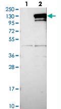 Anti-CCDC146 Rabbit Polyclonal Antibody