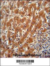 Anti-PKM Rabbit Polyclonal Antibody (Biotin)