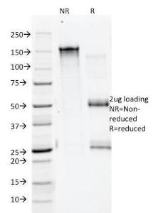 Anti-Annexin A1 Mouse Monoclonal Antibody [clone: 5E4/1]