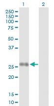 Anti-PPP2R3B Rabbit Polyclonal Antibody