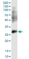 Anti-PPP1R2P3 Polyclonal Antibody Pair