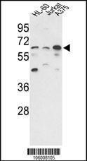 Anti-CALNA3 Rabbit Polyclonal Antibody