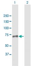 Anti-SNED1 (sushi, nidogen And EGF-like Domains 1) Mouse Polyclonal Antibody