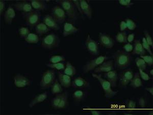 Anti-PEAK1 Mouse Monoclonal Antibody [clone: 3E7]