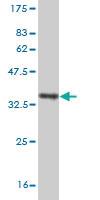 Anti-CXCR4 Mouse Monoclonal Antibody [clone: 2A9]