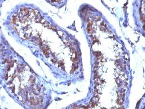 Immunohistochemical analysis of formalin-fixed, paraffin-embedded human testicular carcinoma using Anti-Testosterone Antibody [4E1G2]