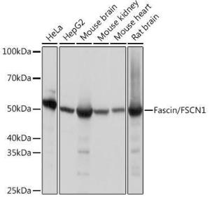 Western blot analysis of extracts of various cell lines, using Anti-Fascin Antibody [ARC1638] (A306042) at 1:1000 dilution