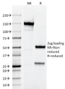 SDS-PAGE analysis of Anti-Testosterone Antibody [4E1G2] under non-reduced and reduced conditions; showing intact IgG and intact heavy and light chains, respectively. SDS-PAGE analysis confirms the integrity and purity of the antibody