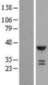 Anti-FOSB Mouse monoclonal antibody unconjugated [clone: 83B1138]