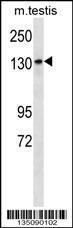 Anti-PEAK1 Rabbit Polyclonal Antibody