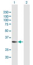 Anti-PPP2R3B Rabbit Polyclonal Antibody