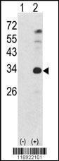 Anti-NANOG Rabbit Polyclonal Antibody (AP (Alkaline Phosphatase))