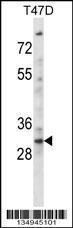 Anti-KLF2 Rabbit Polyclonal Antibody (AP (Alkaline Phosphatase))