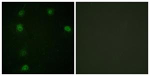 Immunofluorescence analysis of HeLa cells using Anti-Cyclin E1 (phospho Thr77) Antibody The right hand panel represents a negative control, where the antibody was pre-incubated with the immunising peptide