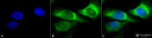 Immunocytochemistry/Immunofluorescence analysis of human heat shocked cervical cancer cell line (HeLa), fixed in 2% formaldehyde for 20 minutes at room temperature, using Anti-HSP47 Antibody [1C4-1A6] (A304884), at 1:100 for 12 hours at 4°C