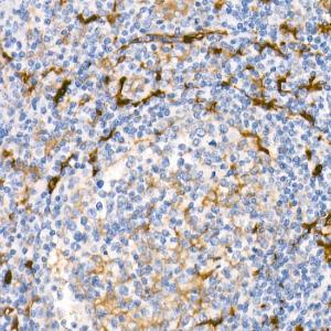 Immunohistochemistry analysis of paraffin-embedded human tonsil using Anti-Fascin Antibody [ARC1638] (A306042) at a dilution of 1:100 (40x lens)