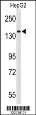 Anti-RECK Rabbit Polyclonal Antibody