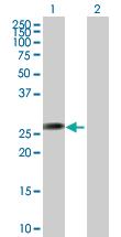 Anti-AGPAT1 Mouse Polyclonal Antibody