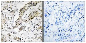 Anti-TCEAL3 + TCEAL5 + TCEAL6 Rabbit Polyclonal Antibody