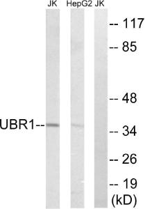 Anti-UBR1 Rabbit Polyclonal Antibody