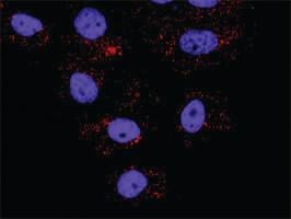 Anti-HDAC2 + HDAC1 Antibody Pair