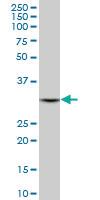 Anti-DECR1 Mouse Monoclonal Antibody [clone: 3D4]