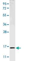 Anti-TNFA Rabbit Polyclonal Antibody