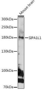 Western blot analysis of extracts of Mouse brain, using Anti-SIPA1L1 Antibody (A308970) at 1:1,000 dilution The secondary antibody was Goat Anti-Rabbit IgG H&L Antibody (HRP) at 1:10,000 dilution Lysates/proteins were present at 25 µg per lane