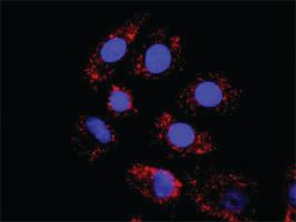 Anti-HDAC2 + HDAC1 Antibody Pair