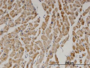 Anti-DECR1 Mouse Monoclonal Antibody [clone: 3D4]