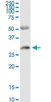 Anti-PPP2R3B Rabbit Polyclonal Antibody