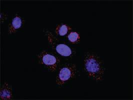 Anti-HDAC2 + HDAC1 Antibody Pair