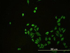 Anti-CD58 Mouse Monoclonal Antibody [clone: 2D11-B10]