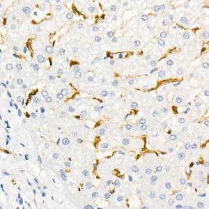 Immunohistochemistry analysis of paraffin-embedded human liver using Anti-Fascin Antibody [ARC1638] (A306042) at a dilution of 1:100 (40x lens). Perform microwave antigen retrieval with 10 mM Tris/EDTA buffer pH 9.0 before commencing with IHC staining protocol