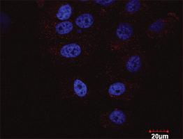 Anti-HDAC2 + HDAC1 Antibody Pair