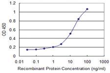 Anti-DECR1 Mouse Monoclonal Antibody [clone: 3D4]