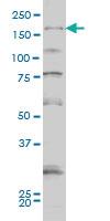 Anti-SYNJ1 Mouse Monoclonal Antibody [clone: 1A2]