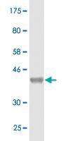 Anti-CBS Mouse Monoclonal Antibody [clone: 3D10]