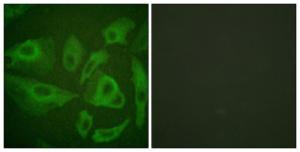 Immunofluorescence analysis of HeLa cells using Anti-FAS Antibody. The right hand panel represents a negative control, where the antibody was pre-incubated with the immunising peptide.