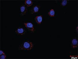 Anti-HDAC2 + HDAC1 Antibody Pair