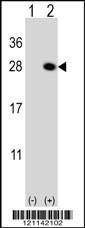 Anti-QDPR Rabbit Polyclonal Antibody