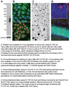 A: Western blot analysis of c-Fos expression in HeLa cells. B: Immunofluorescence staining of HeLa cells. C: Immunohistochemistry on 4% PFA transcardial-perfused mouse brain sections. D: Immunohistochemistry on mouse cortical sections.