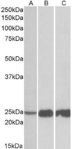 Anti-TNNI2 Antibody (A82885) (0.03 µg/ml) staining of Human (A), Mouse(B) and Rat (C) Skeletal Muscle lysate (35 µg protein in RIPA buffer). Primary incubation was 1 hour. Detected by chemiluminescence