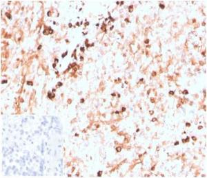 Immunohistochemical analysis of formalin-fixed, paraffin-embedded human spleen tissue using Anti-Lambda Light Chain Antibody [LLC/3774R]. Inset: PBS instead of the primary antibody. Secondary antibody negative control