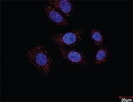 Anti-HDAC2 + HDAC1 Antibody Pair