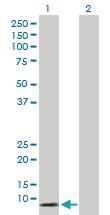 Anti-DEFA5 Rabbit Polyclonal Antibody