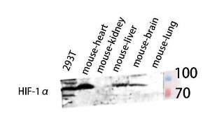 Western blot analysis of 293T, mouse brain, mouse spleen, and mouse heart lysis using Anti-HIF-1alpha Antibody