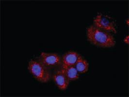 Anti-RPS6KA3 + PDPK1 Polyclonal Antibody Pair