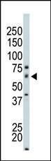 Anti-PAK4 Rabbit Polyclonal Antibody (APC (Allophycocyanin))