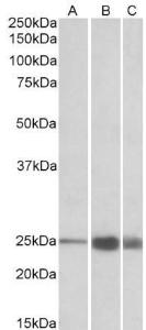 Anti-TNNI2 Antibody (A82886) (1 µg/ml) staining of Human (A), Mouse(B) and Rat (C) Skeletal Muscle lysate (35 µg protein in RIPA buffer). Primary incubation was 1 hour. Detected by chemiluminescence